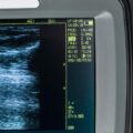 Ecógrafo portátil Handscan V8